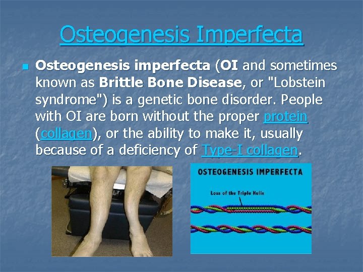 Osteogenesis Imperfecta n Osteogenesis imperfecta (OI and sometimes known as Brittle Bone Disease, or