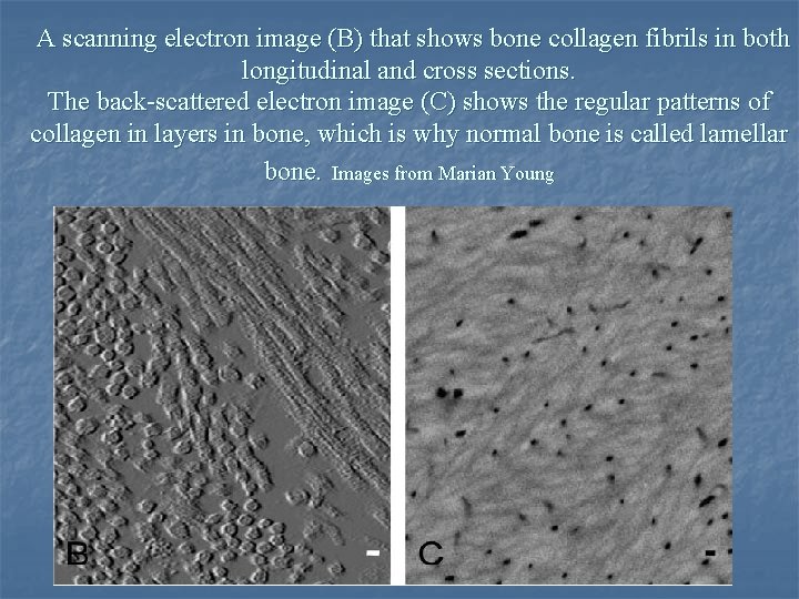 A scanning electron image (B) that shows bone collagen fibrils in both longitudinal and