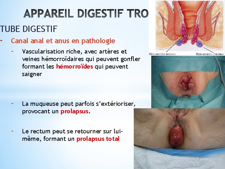 TUBE DIGESTIF - Canal et anus en pathologie - Vascularisation riche, avec artères et