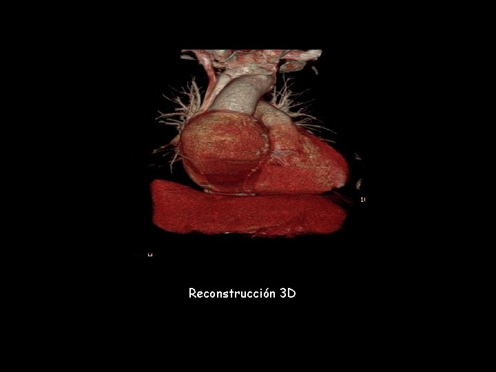 Reconstrucción 3 D 