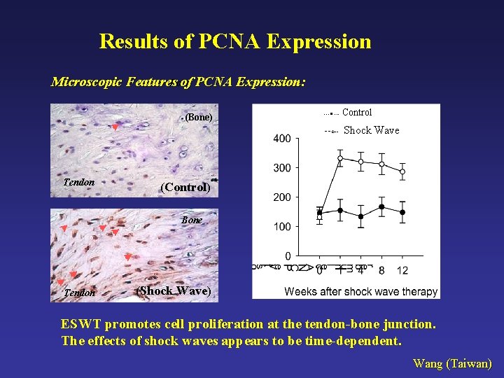 Results of PCNA Expression Microscopic Features of PCNA Expression: Bone (Bone) ---● --- Control