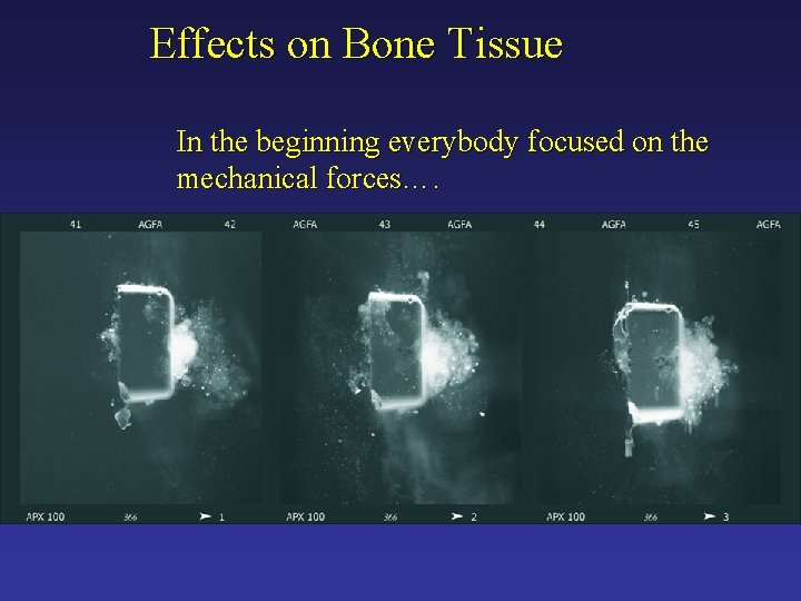 Effects on Bone Tissue In the beginning everybody focused on the mechanical forces…. 