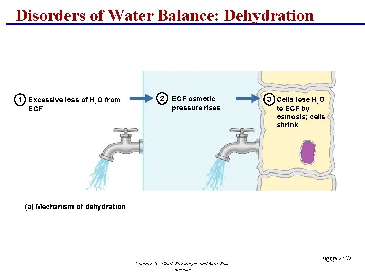 Disorders of Water Balance: Dehydration 1 Excessive loss of H 2 O from ECF