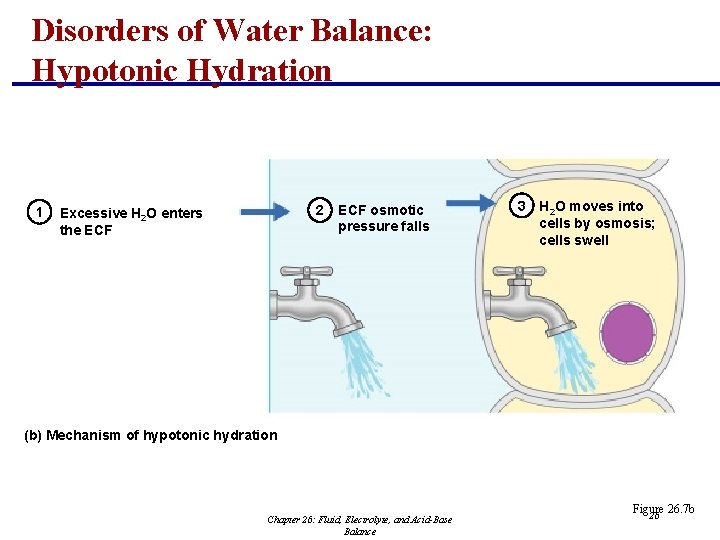 Disorders of Water Balance: Hypotonic Hydration 1 2 Excessive H 2 O enters the