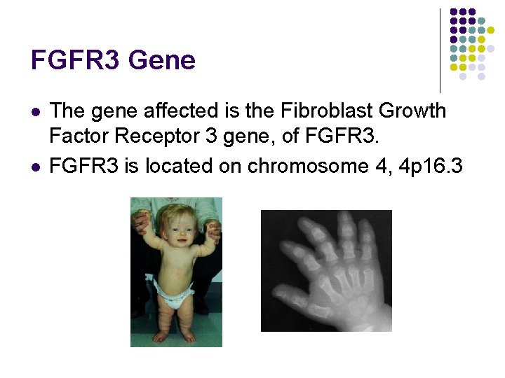 FGFR 3 Gene l l The gene affected is the Fibroblast Growth Factor Receptor