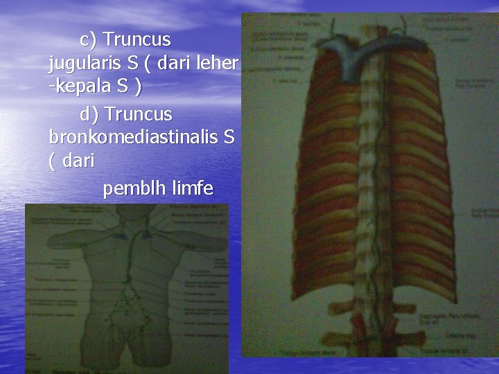 c) Truncus jugularis S ( dari leher -kepala S ) d) Truncus bronkomediastinalis S