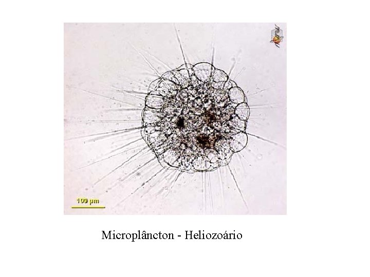 Microplâncton - Heliozoário 