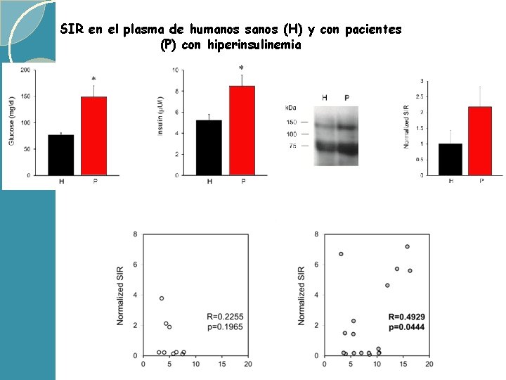 SIR en el plasma de humanos sanos (H) y con pacientes (P) con hiperinsulinemia