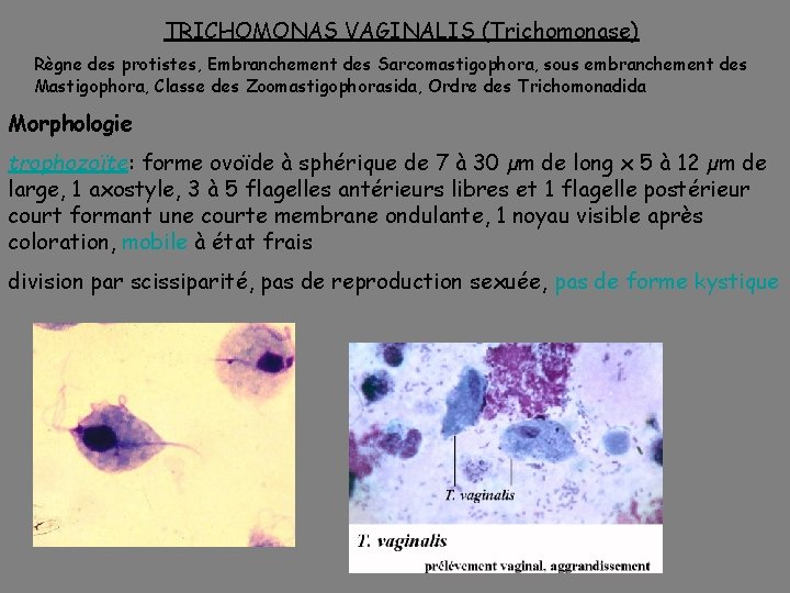 TRICHOMONAS VAGINALIS (Trichomonase) Règne des protistes, Embranchement des Sarcomastigophora, sous embranchement des Mastigophora, Classe