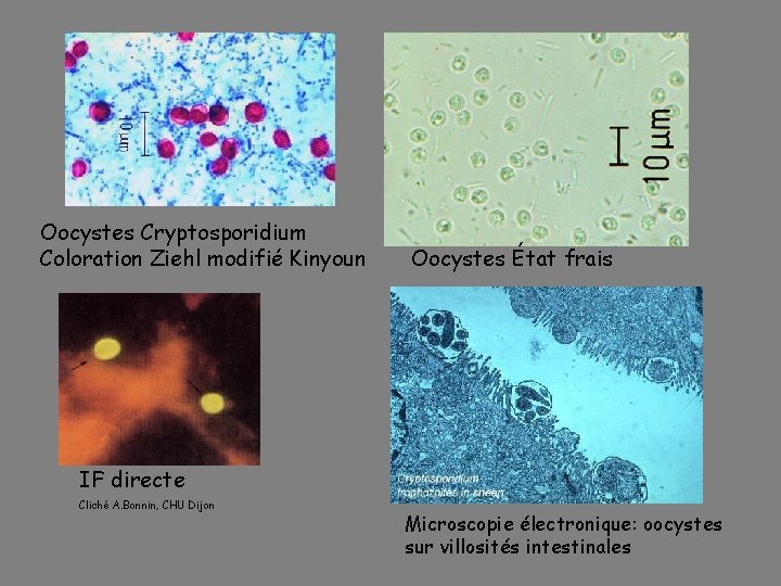 Oocystes Cryptosporidium Coloration Ziehl modifié Kinyoun Oocystes État frais IF directe Cliché A. Bonnin,
