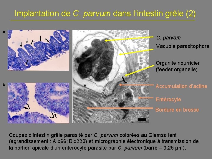 Implantation de C. parvum dans l’intestin grêle (2) A C. parvum Vacuole parasitophore LP