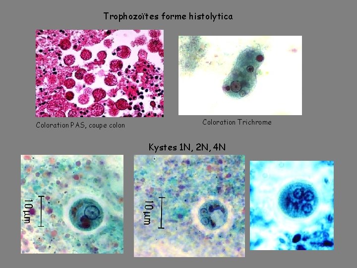 Trophozoïtes forme histolytica Coloration PAS, coupe colon Coloration Trichrome Kystes 1 N, 2 N,