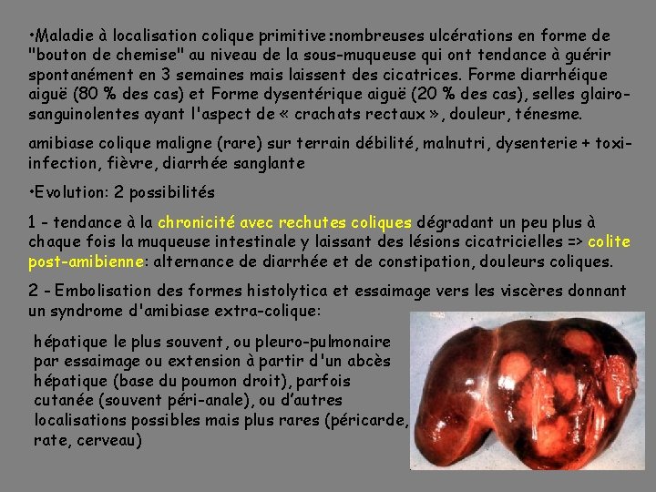  • Maladie à localisation colique primitive: nombreuses ulcérations en forme de "bouton de