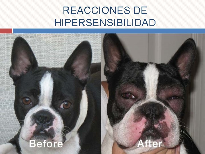 REACCIONES DE HIPERSENSIBILIDAD 