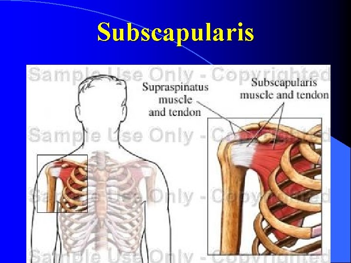 Subscapularis 