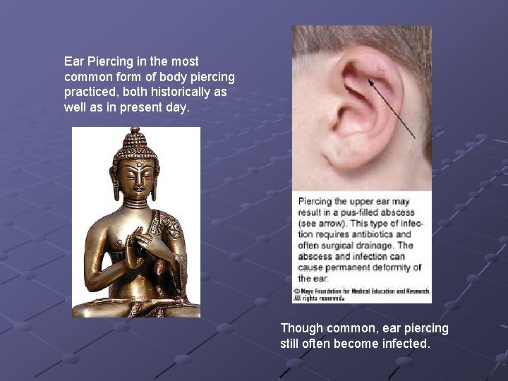 Ear Piercing in the most common form of body piercing practiced, both historically as