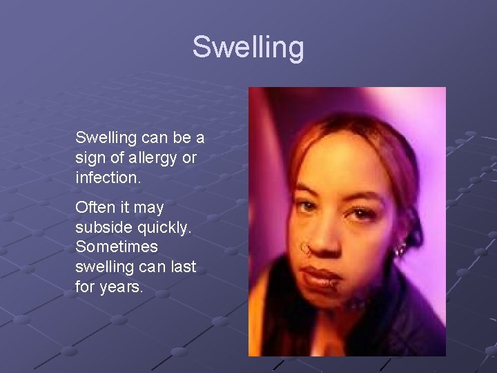 Swelling can be a sign of allergy or infection. Often it may subside quickly.