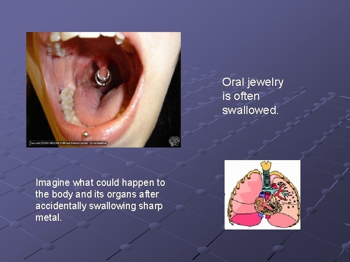 Oral jewelry is often swallowed. Imagine what could happen to the body and its Oral jewelry is often swallowed. Imagine what could happen to the body and its