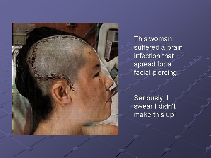 This woman suffered a brain infection that spread for a facial piercing. Seriously, I