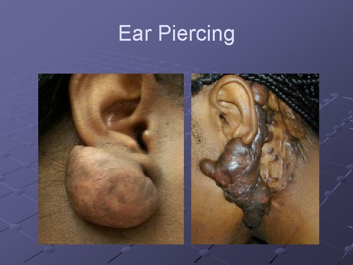 Ear Piercing 