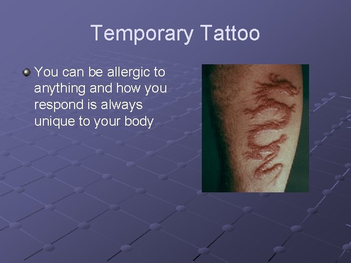 Temporary Tattoo You can be allergic to anything and how you respond is always