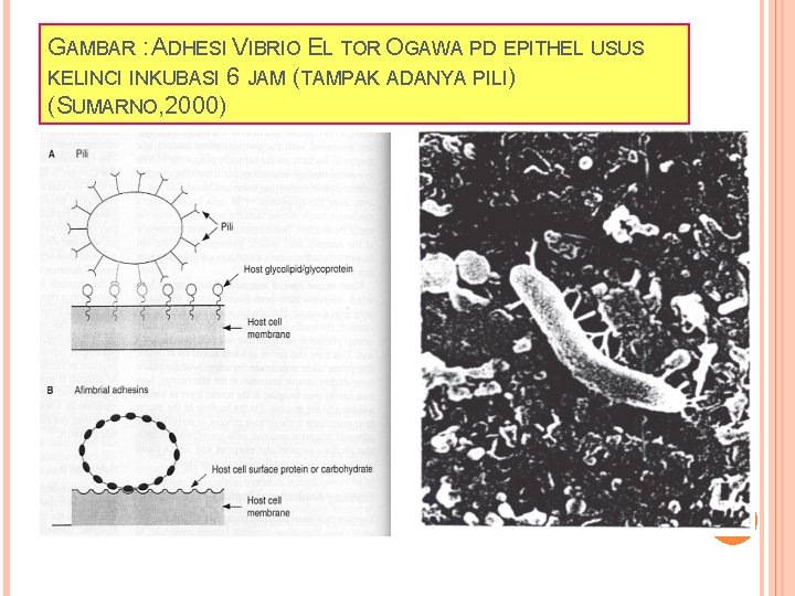 GAMBAR : ADHESI VIBRIO EL TOR OGAWA PD EPITHEL USUS KELINCI INKUBASI 6 JAM