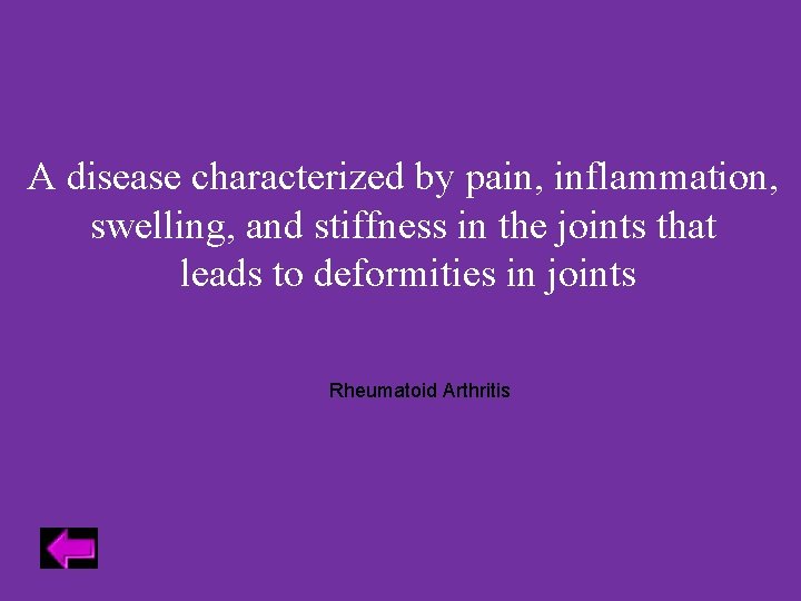 A disease characterized by pain, inflammation, swelling, and stiffness in the joints that leads