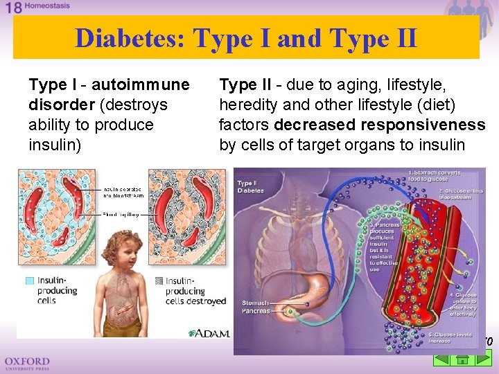 Diabetes: Type I and Type II Type I - autoimmune disorder (destroys ability to