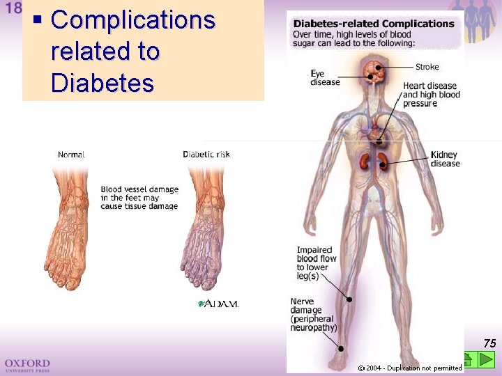  Complications related to Diabetes 75 