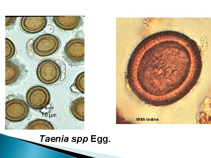 With Iodine Taenia spp Egg. 