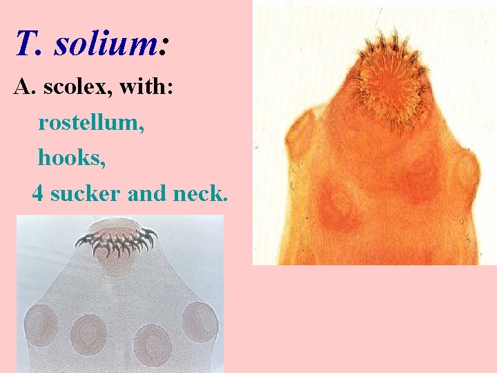 T. solium: A. scolex, with: rostellum, hooks, 4 sucker and neck. 