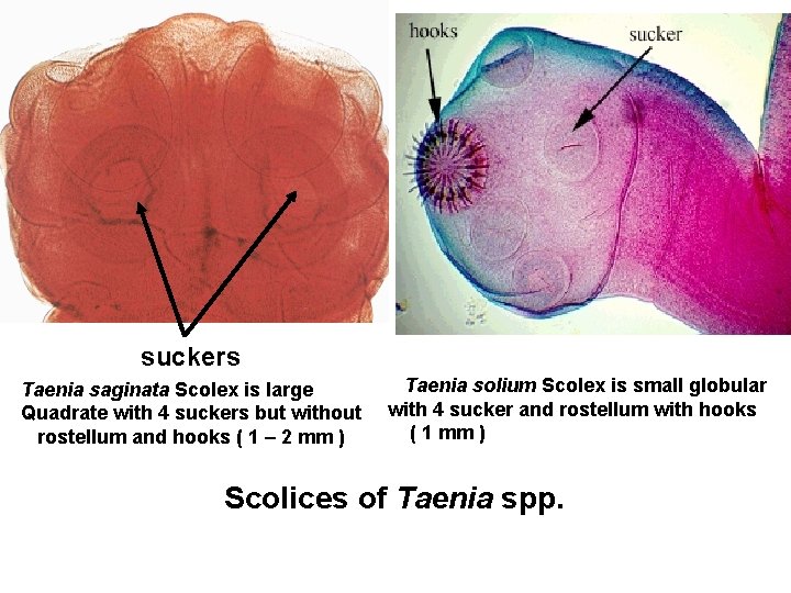 suckers Taenia saginata Scolex is large Quadrate with 4 suckers but without rostellum and