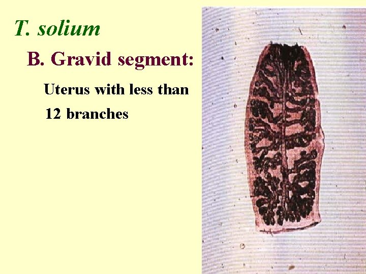 T. solium B. Gravid segment: Uterus with less than 12 branches 