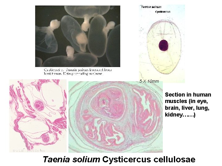 5 X 10 mm Section in human muscles (in eye, brain, liver, lung, kidney……)