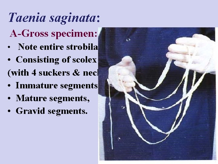 Taenia saginata: A-Gross specimen: • Note entire strobila, • Consisting of scolex (with 4
