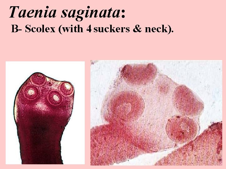 Taenia saginata: B- Scolex (with 4 suckers & neck). 