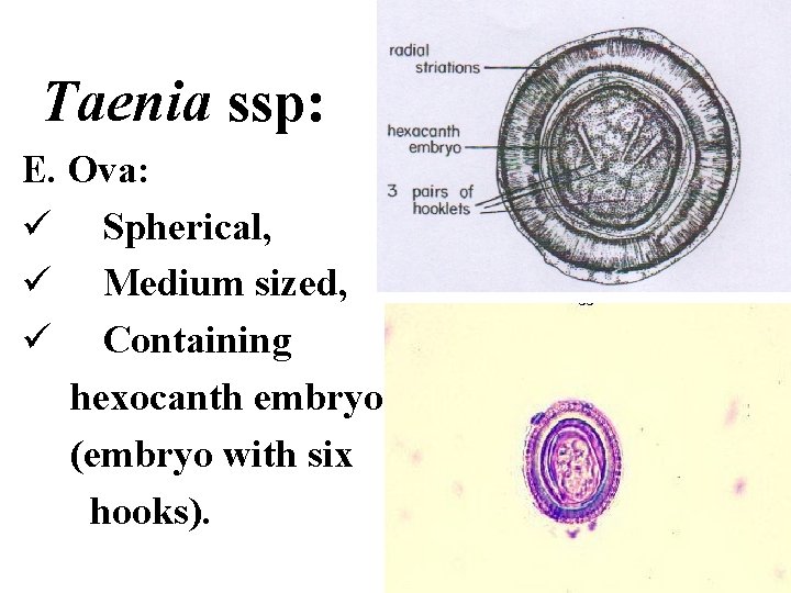 Taenia ssp: E. Ova: ü Spherical, ü Medium sized, ü Containing hexocanth embryo (embryo