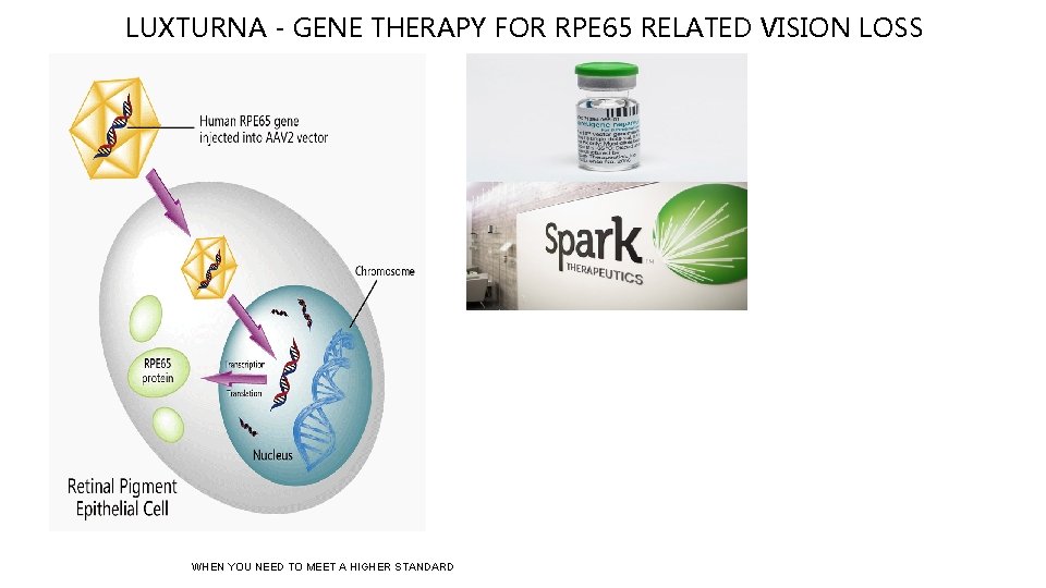 LUXTURNA - GENE THERAPY FOR RPE 65 RELATED VISION LOSS WHEN YOU NEED TO