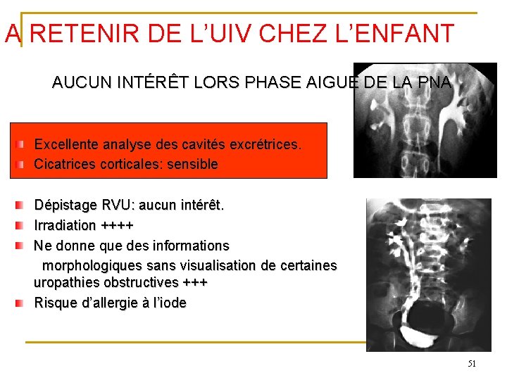 A RETENIR DE L’UIV CHEZ L’ENFANT AUCUN INTÉRÊT LORS PHASE AIGUE DE LA PNA