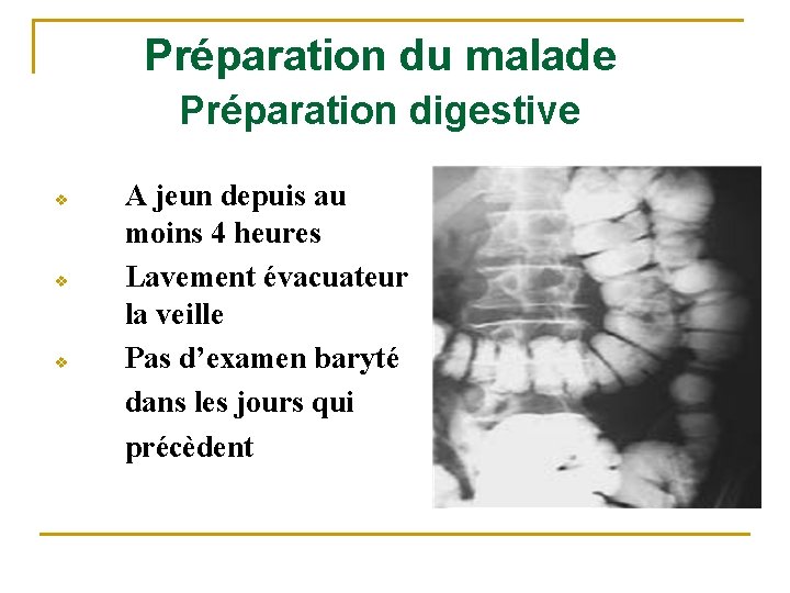 Préparation du malade Préparation digestive v v v A jeun depuis au moins 4