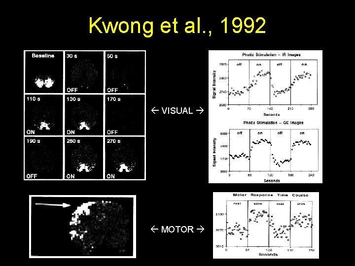 Kwong et al. , 1992 VISUAL MOTOR 