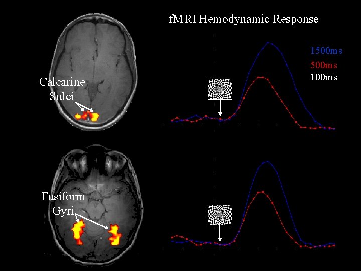 f. MRI Hemodynamic Response Calcarine Sulci Fusiform Gyri 1500 ms 100 ms 