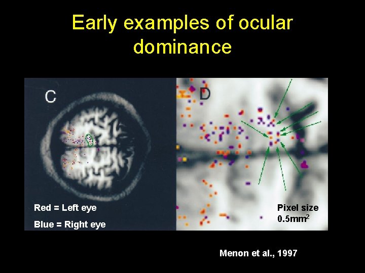 Early examples of ocular dominance Red = Left eye Blue = Right eye Pixel