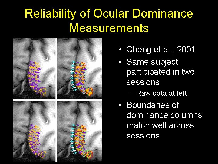 Reliability of Ocular Dominance Measurements • Cheng et al. , 2001 • Same subject