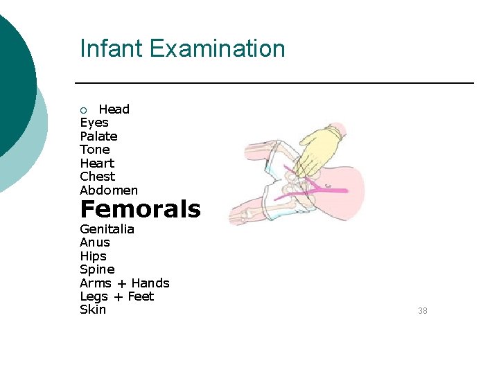 Infant Examination Head Eyes Palate Tone Heart Chest Abdomen ¡ Femorals Genitalia Anus Hips