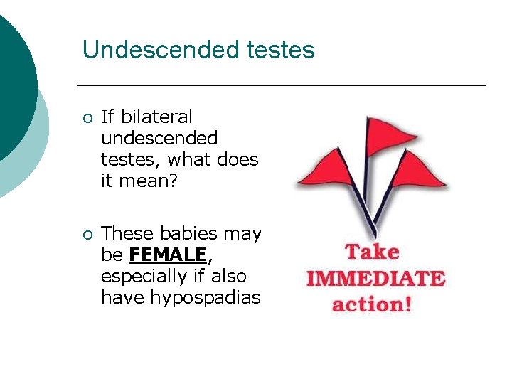 Undescended testes ¡ ¡ If bilateral undescended testes, what does it mean? These babies