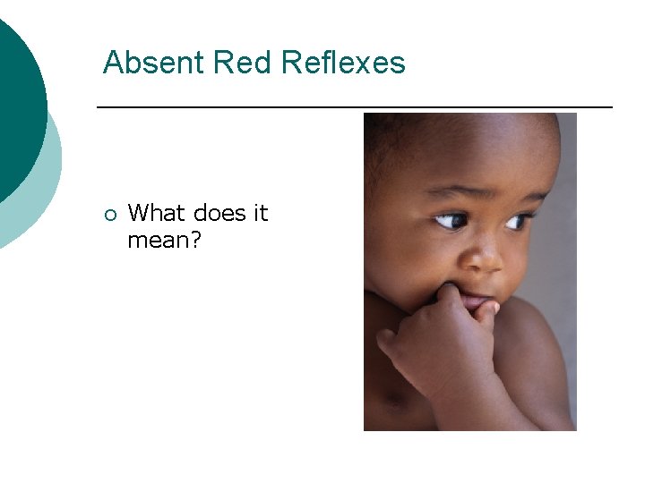 Absent Red Reflexes ¡ What does it mean? Take Action 