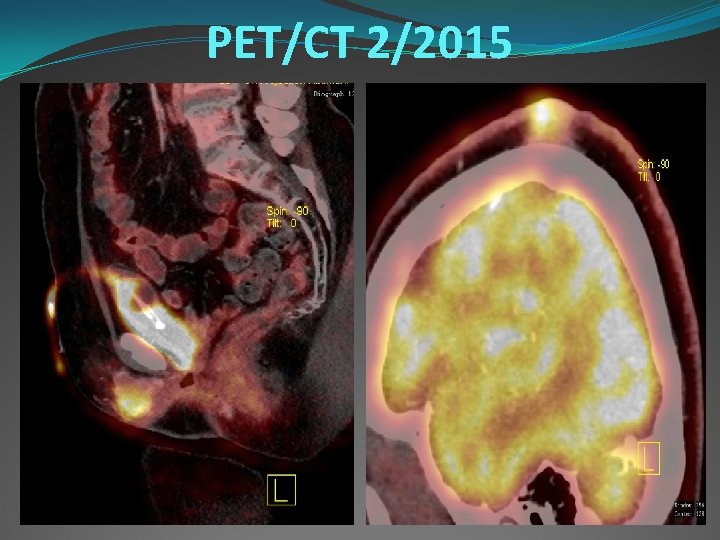 PET/CT 2/2015 