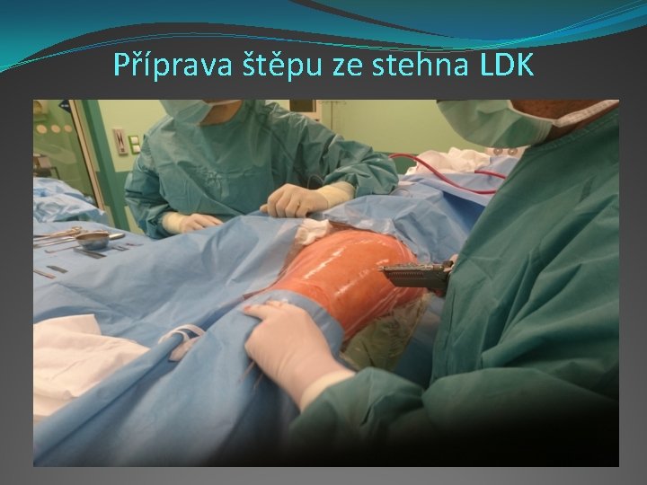 Příprava štěpu ze stehna LDK 