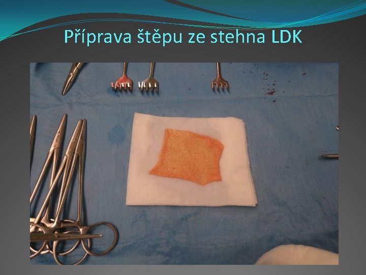 Příprava štěpu ze stehna LDK 